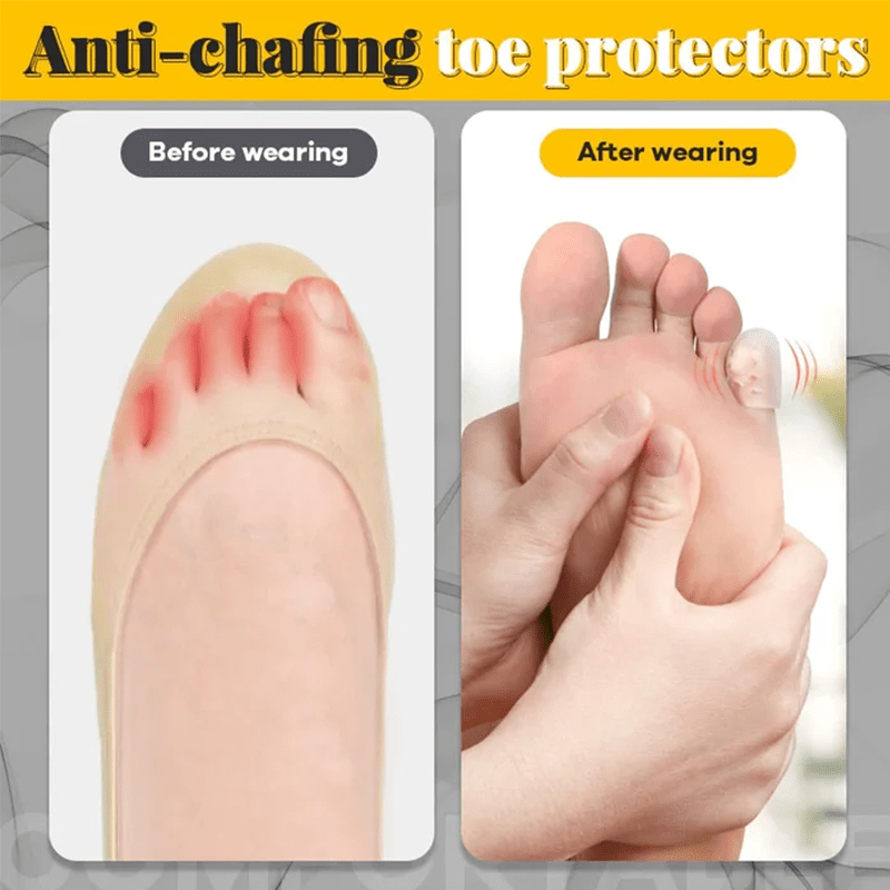 Silicone Anti-Friction Toe Protector (10pcs)